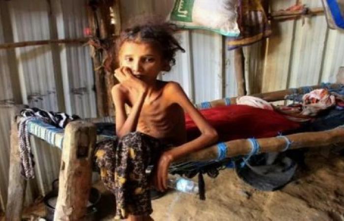 فيديو| اليمن المنسي.. حلم التغيير تحول إلى حرب ومجاعة