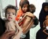 ربع مليون شخص يصارعون الموت.. الجوع ينهش أجساد اليمنيين