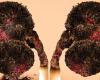 المصري اليوم - اخبار مصر- حسام موافي يكشف عن علاقة السرطان بالتدخين: «شكل رئة المدخن مرعب» موجز نيوز